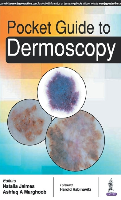 Pocket Guide to Dermoscopy by Natalia, Jaimes