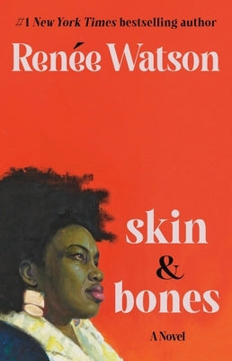 Skin & Bones by Watson, Renée