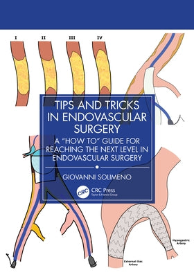 Tips and Tricks in Endovascular Surgery: A "How to" Guide for reaching the next Level in Endovascular Surgery by Solimeno, Giovanni