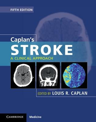 Caplan's Stroke: A Clinical Approach by Caplan, Louis R.