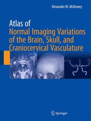 Atlas of Normal Imaging Variations of the Brain, Skull, and Craniocervical Vasculature by McKinney, Alexander M.