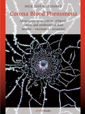 Corona Blood Phenomena: Microscopic Examinations of Blood, Serum, and Cerebrospinal Fluid: Healthy - Vaccinated - Recovered by Just-Nastansky, Inge