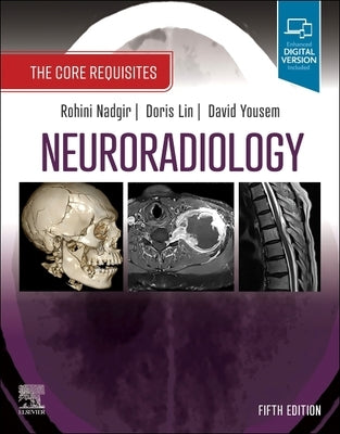 Neuroradiology: The Core Requisites by Nadgir, Rohini