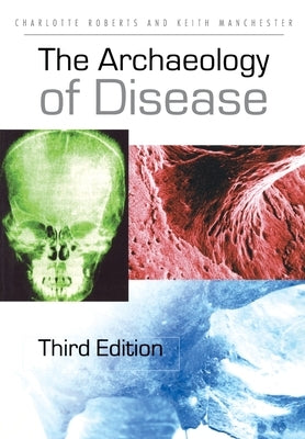 The Archaeology of Disease by Roberts, Charlotte