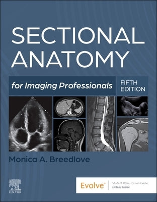Sectional Anatomy for Imaging Professionals by Breedlove, Monica