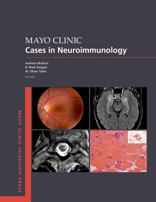 Mayo Clinic Cases in Neuroimmunology by McKeon, Andrew