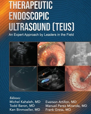 Therapeutic Endoscopic Ultrasound (TEUS) by Kahaleh, Michel