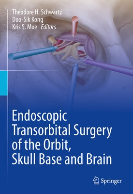 Endoscopic Transorbital Surgery of the Orbit, Skull Base and Brain by Schwartz, Theodore H.