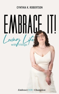 Embrace It: Loving Life with Vitiligo by Robertson, Cynthia