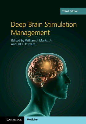 Deep Brain Stimulation Management by Marks, William J.