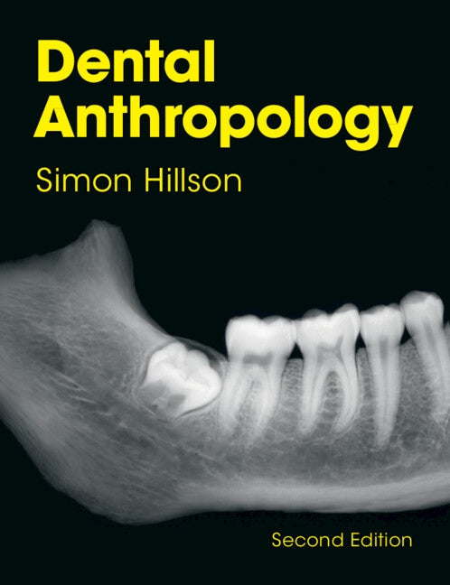 Dental Anthropology by Hillson, Simon