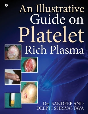 An Illustrative Guide on Platelet Rich Plasma by Dr Sandeep