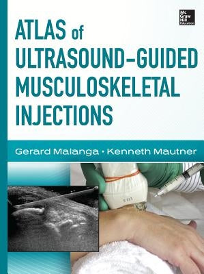 Atlas of Ultrasound-Guided Musculoskeletal Injections by Malanga, Gerard