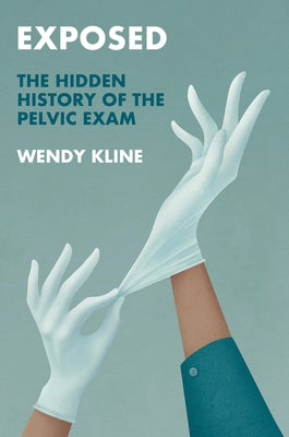 Exposed: The Hidden History of the Pelvic Exam by Kline, Wendy